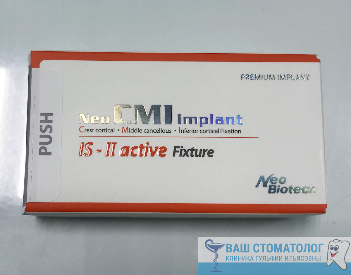 Имплантация зубов в Самаре